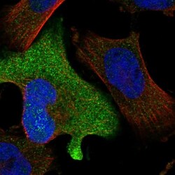 ZNF582 Antibody, Novus Biologicals 0.1mL; Unlabeled:Antibodies, Polyclonal
